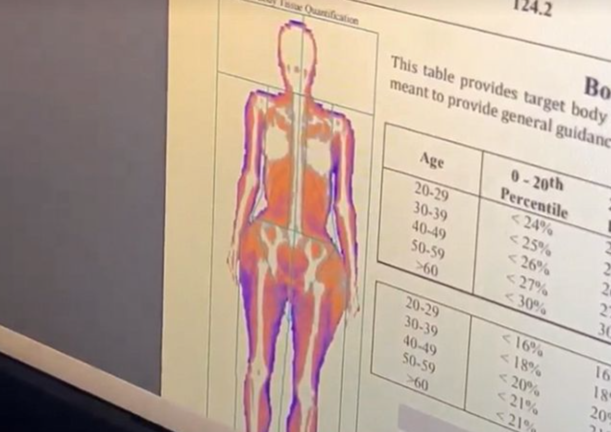 Kim Kardashian Got a DEXA Scan and Shared Her Results!