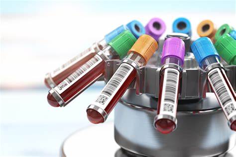 Unlock your health potential with DEXA Scans, VO2 Testing, and Comprehensive Lab work: