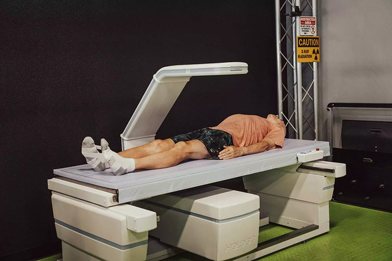 How to Read and Interpret Your DEXA Scan Results