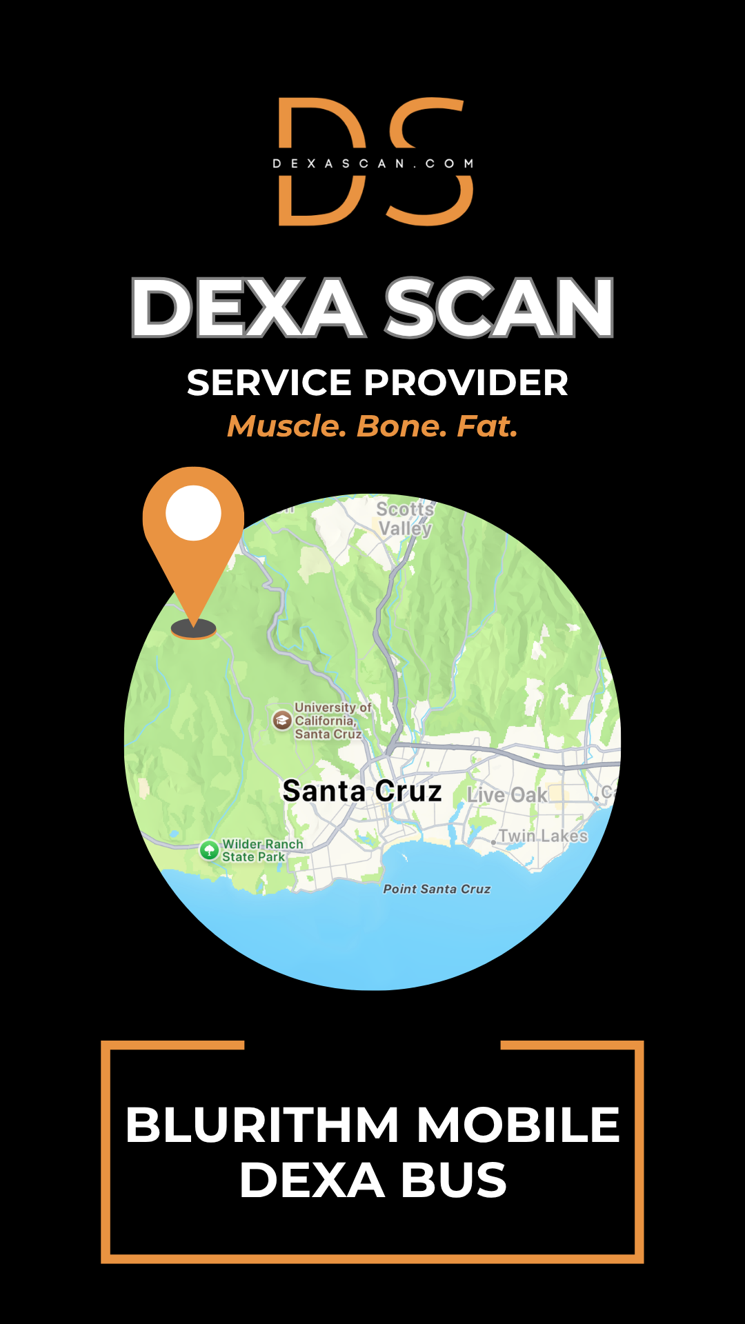 Mobile DEXA Scan in Los Gatos, CA