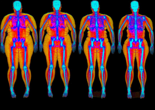 Lose Fat, Not Muscle in 2026: A Data-Driven Guide Using DEXA Body Composition