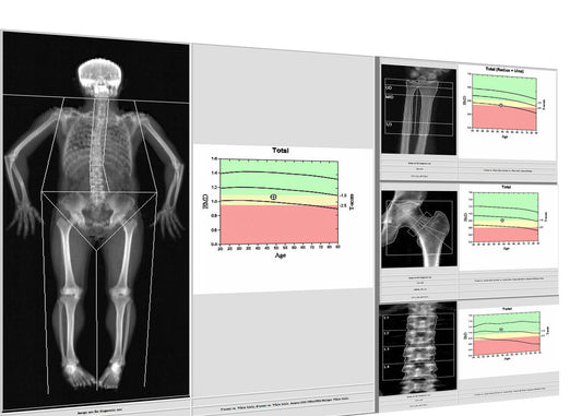 Understanding Your DEXA Scan Results: What They Mean and How to Track Your Progress