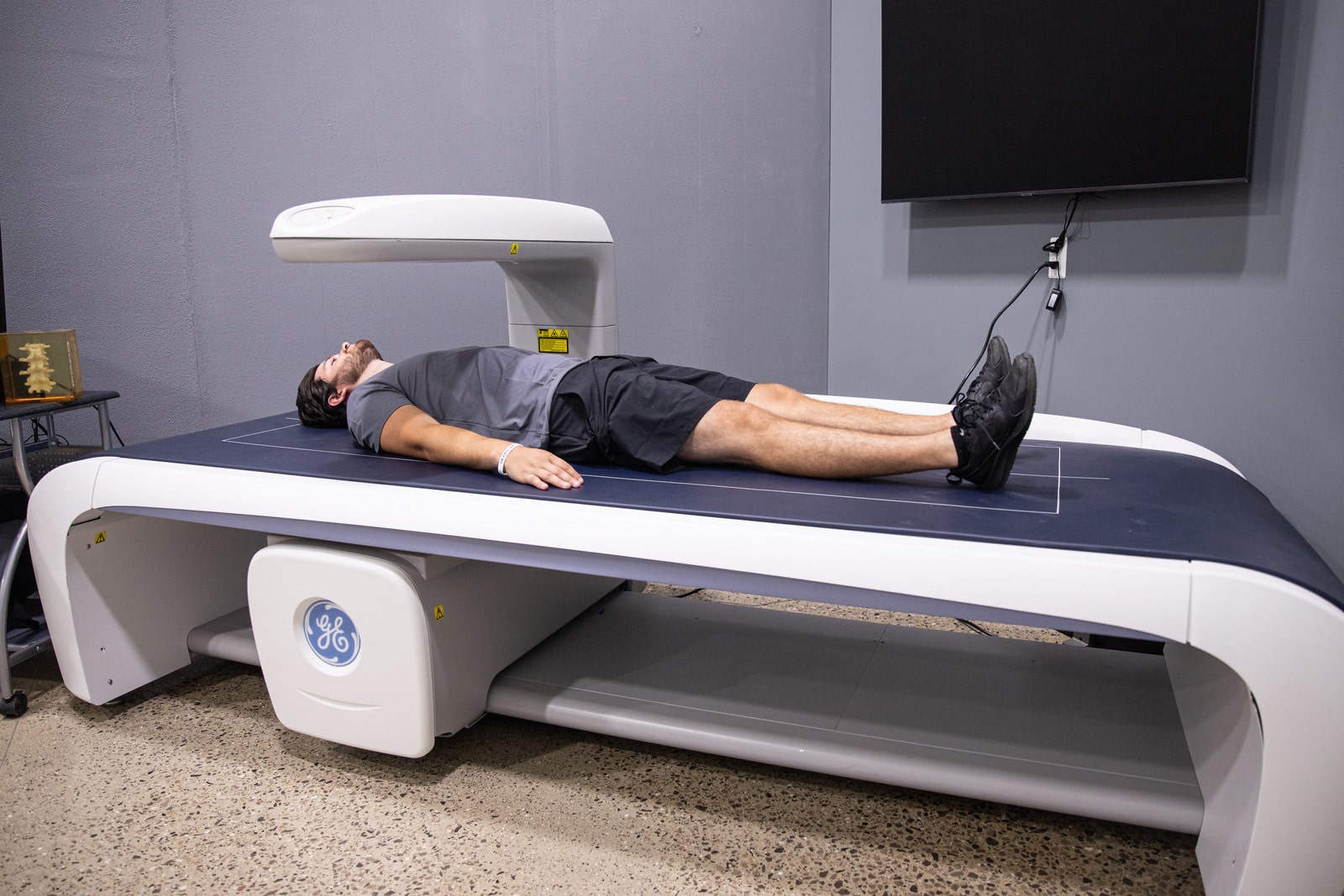 How Often Should You Get A New DEXA Scan?