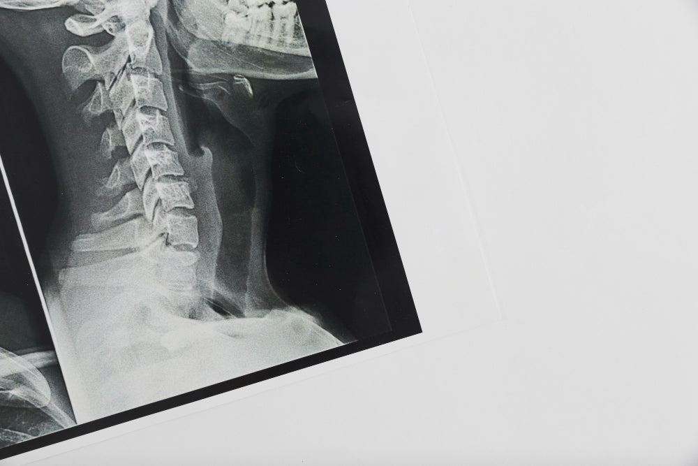 bone density scan 