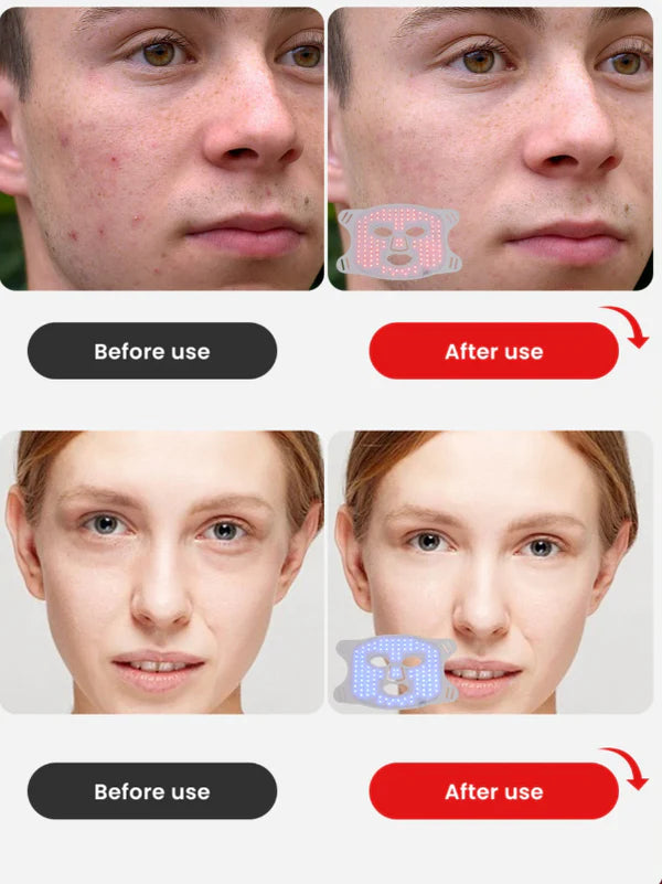 Red & Blue Light Therapy Face Neck & Chest Mask | Anti-Aging & Acne Solution by DEXA+