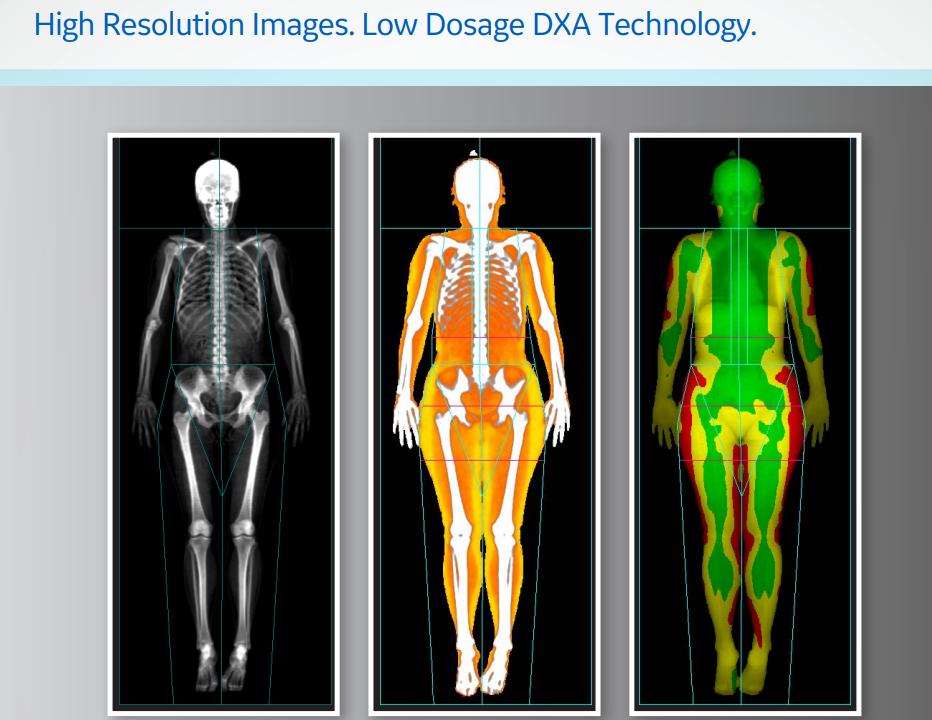 Free Guide How to Ready Your DEXA Scan Results