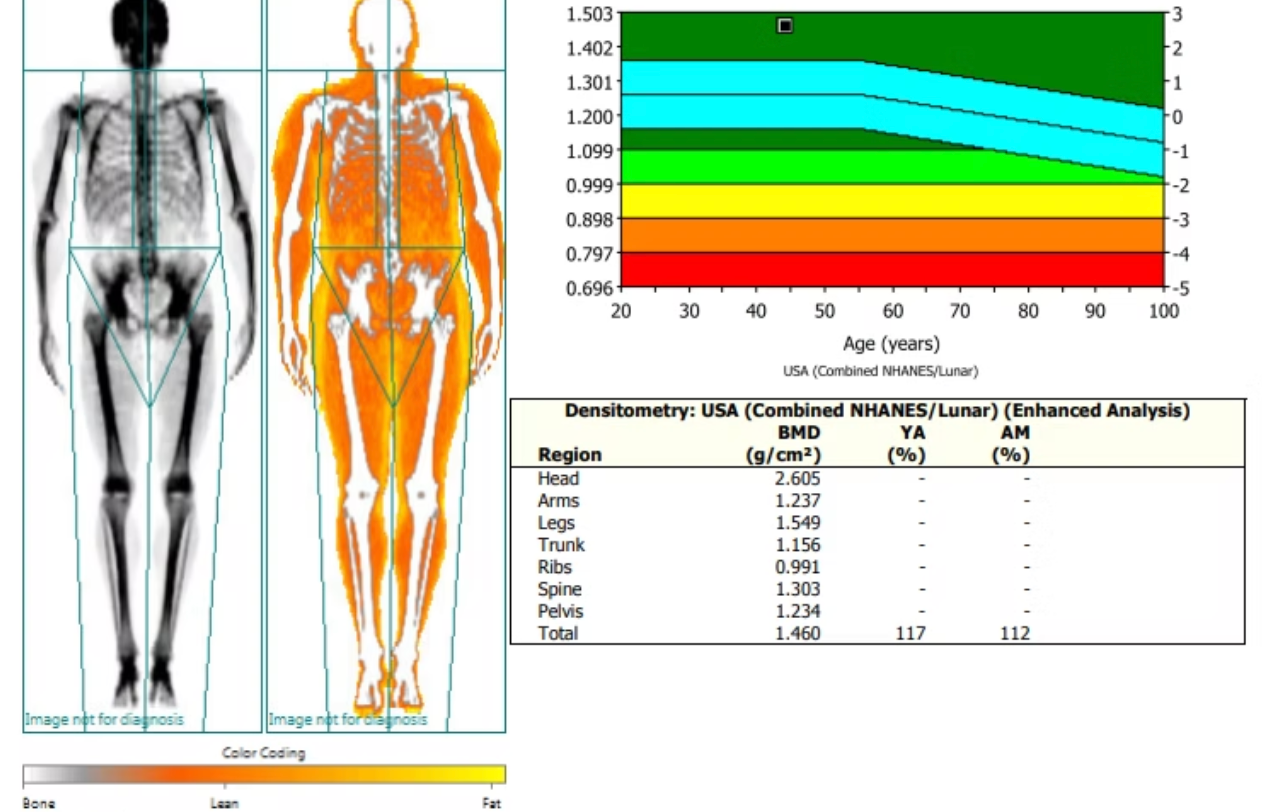dexa results