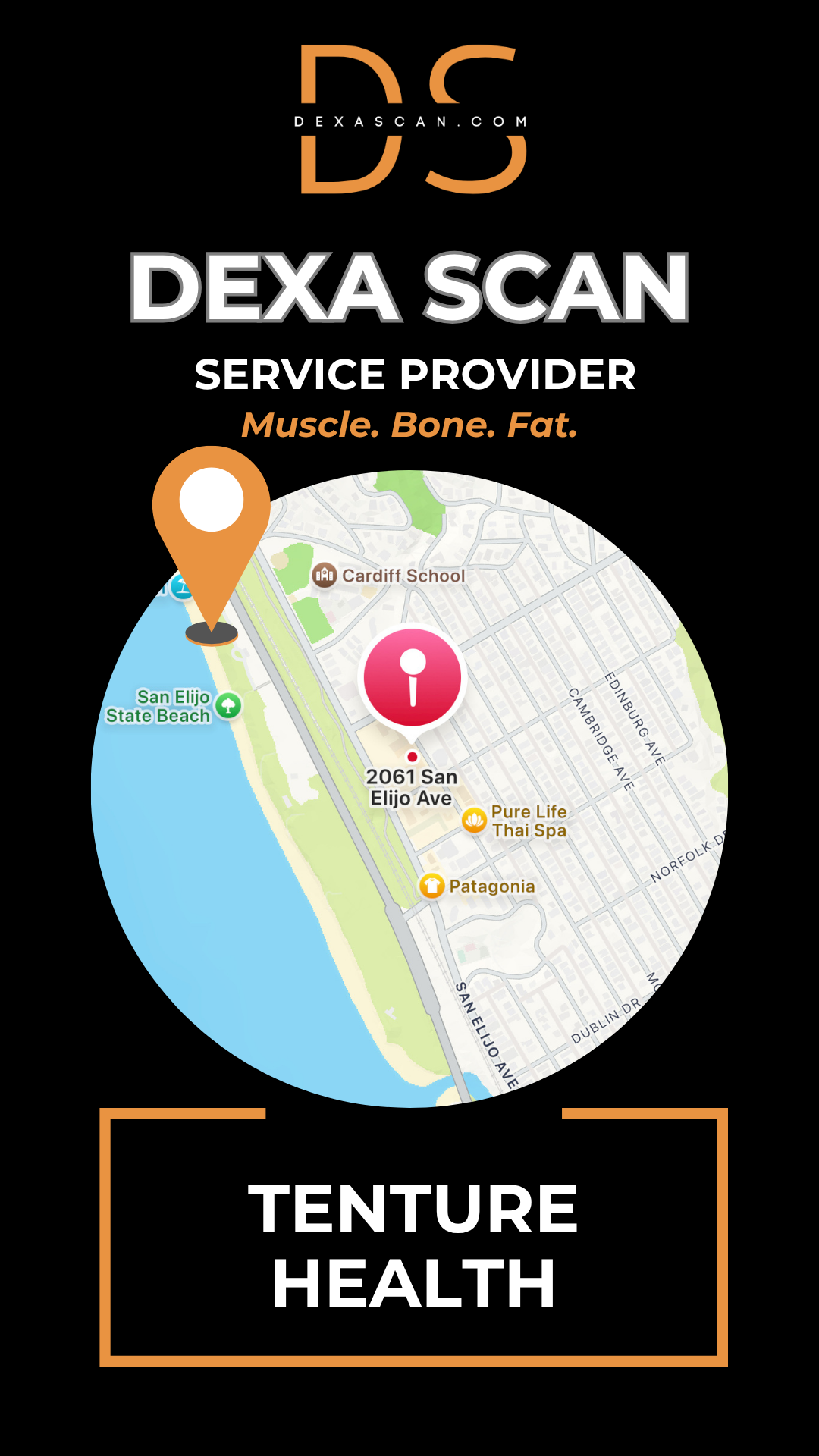 DEXA Scan in San Diego (Cardiff), CA